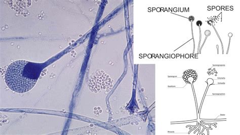 Zygomycota Sporangium New Page 1