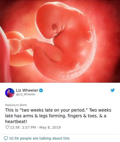Woman's bid to shame pro-choicers with 6 week foetus image gets shattered by science - The Mirror