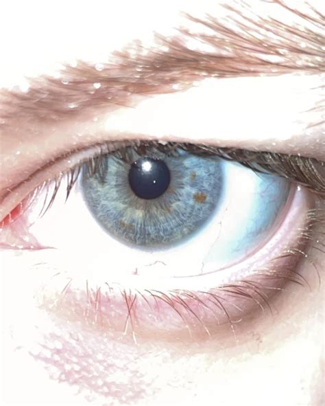 lil freckle : r/eyes
