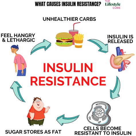 Insulin Resistance Diet for Diabetes