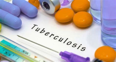 Must be aware of these ways to prevent tuberculosis | TheHealthSite.com