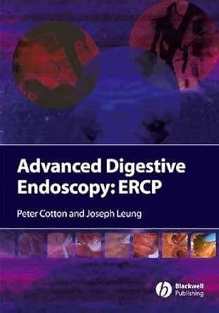 Advanced Digestive Endoscopy: ERCP eBook : Cotton, Peter B., Leung ...