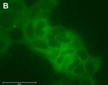 Anti-MEK1 Antibody, clone 1F18 ZooMAb® Rabbit Monoclonal recombinant ...
