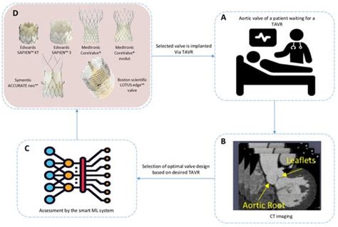Latest Developments in Adapting Deep Learning for Assessing TAVR ...