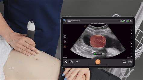 Image result for Biometry Ob