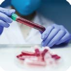 Important Tests Cover Under Cardiac Profile Test