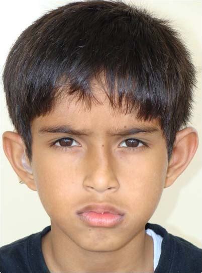 Happy Patient Smile Gallry - World Class Dental Clinic