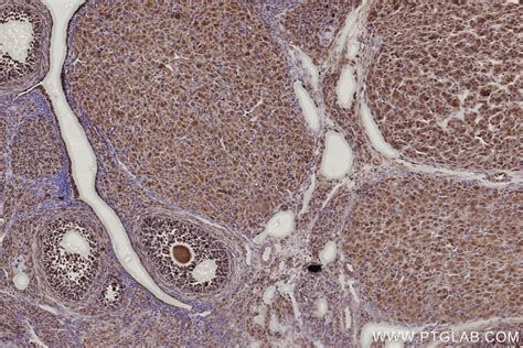 IHCeasy CCDC99 Ready-To-Use IHC Kit KHC2787 | Proteintech