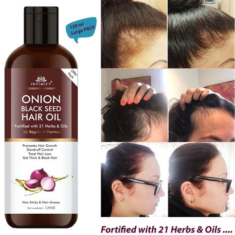 Intimify onion oil, anti dandruff oil, herbal oil, hair fall oil, red ...