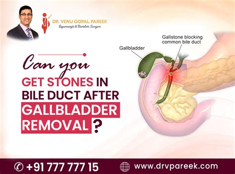 Gallstones In Gallbladder
