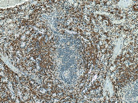 CD42a / GP9 antibody (67271-1-Ig) | Proteintech