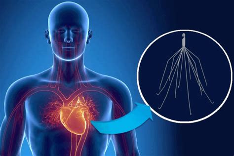 Services - The Heart Centre | Where the Heart Continues to Beat