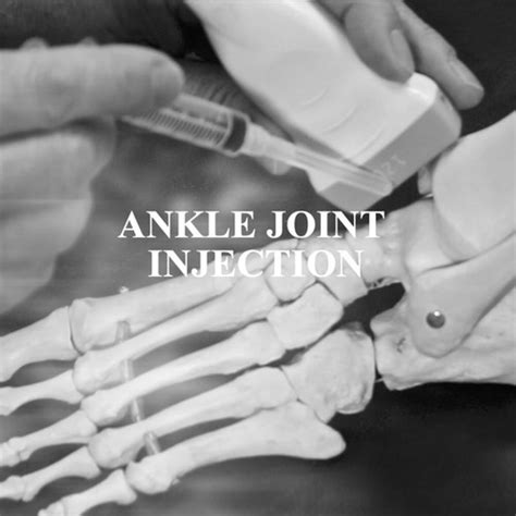Image result for Ankle Injection Procedure