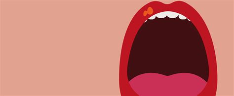 Barretos possui o maior índice de diagnóstico de câncer bucal em fases iniciais de SP | Hospital ...