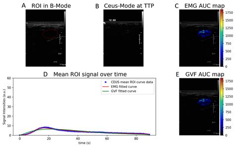 Quantification and Classification of Contrast Enhanced Ultrasound ...