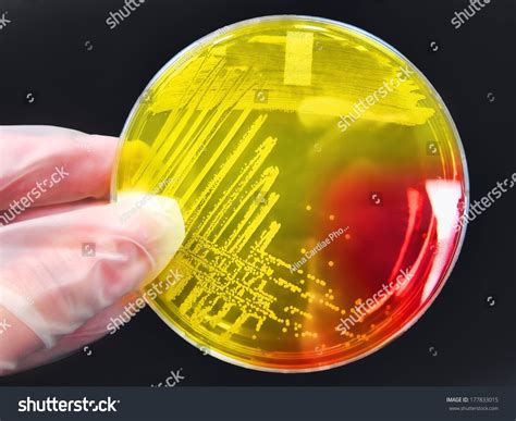 Bacterial Pathogen Staphylococcus S. Aureus Colony On An Agar Streak ...