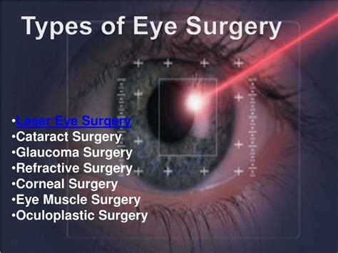 PPT - Eye Surgery in India & Eye Treatment in India PowerPoint Presentation - ID:7142087