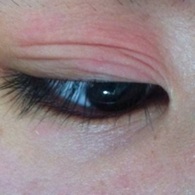 眼屎异常增多，或眼健康存在隐患__凤凰网