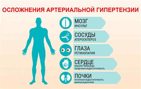 Как снизить давление в домашних условиях: как понизить давление ...