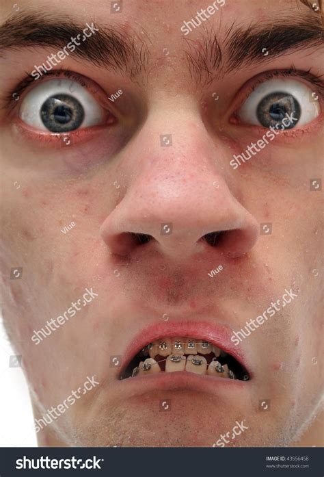 That'S Not A Frown, That'S An Upside Down Smile! Stock Photo 43556458 ...