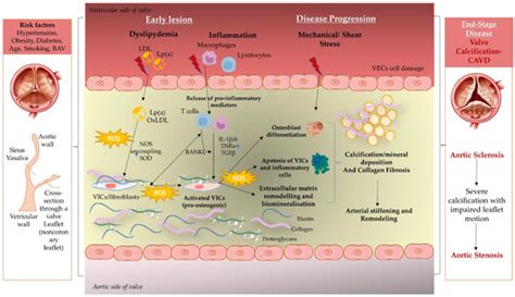 Contribution of Oxidative Stress (OS) in Calcific Aortic Valve Disease ...