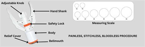 Stapler Circumcision – High volume Center for Stapler circumcision in ...