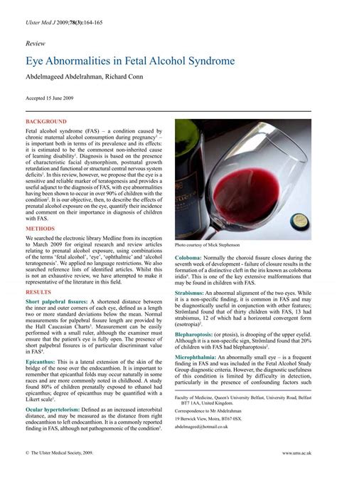 Eye Abnormalities in Fetal Alcohol Syndrome - Ulster Medical Society