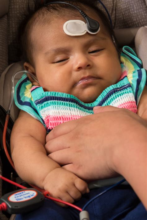 CMV: A Leading Cause of Newborn Hearing Loss that You’ve Never Heard Of ...