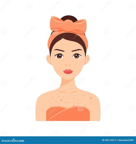 Beautiful Woman with Acne on Chest and Neck. Skin Problems on Breast ...