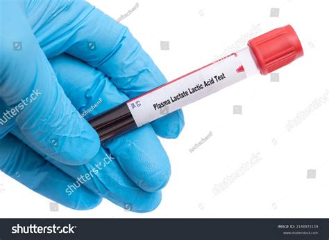 Plasma Lactate Lactic Acid Test Medical Stock Photo 2148972159 ...