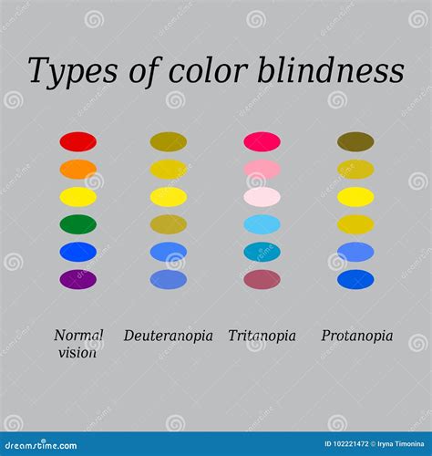 Types of Color Blindness. Eye Color Perception Stock Vector - Illustration of color, blind ...