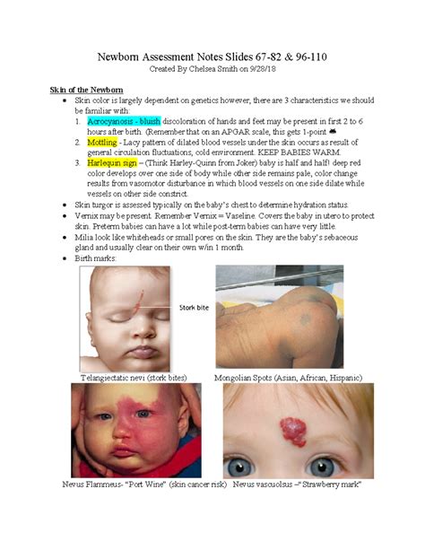 Acrocyanosis In Infants
