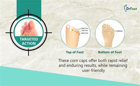 Buy Corn Cap Combo: Fast & Effective Corn Remover for Feet – Drfootin