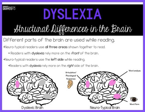 What Are The Different Forms Of Dyslexia at Danny Garza blog