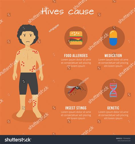 Causes Of Hives
