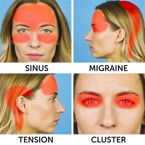 7 Pressure Points to Relieve Headaches | How to use acupressure points for headac… | Acupressure ...