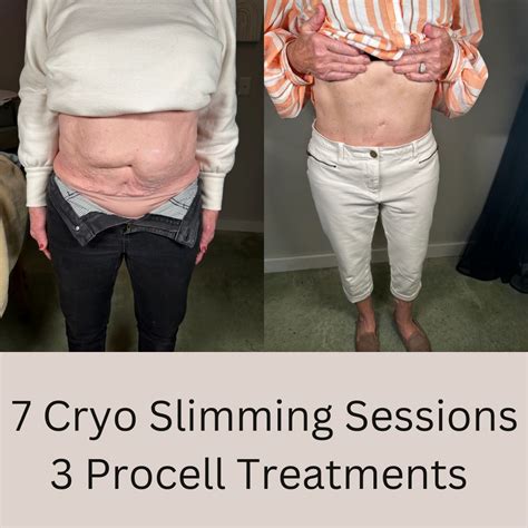 Cryo Slim Session from Sunset Spa | Maines Best Deals