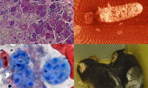 Image result for Free Pathophysiology Course