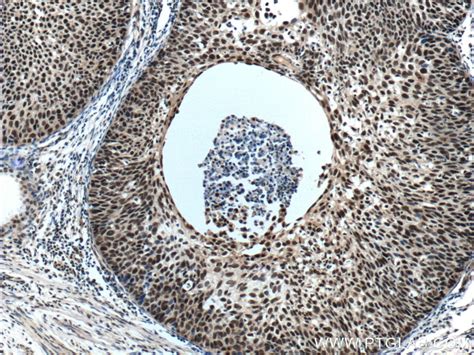 ZC3H18 antibody (25807-1-AP) | Proteintech