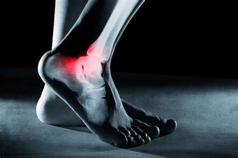 Do You Have Foot & Ankle Pain? - Cellaxys [Stem Cell Therapy]