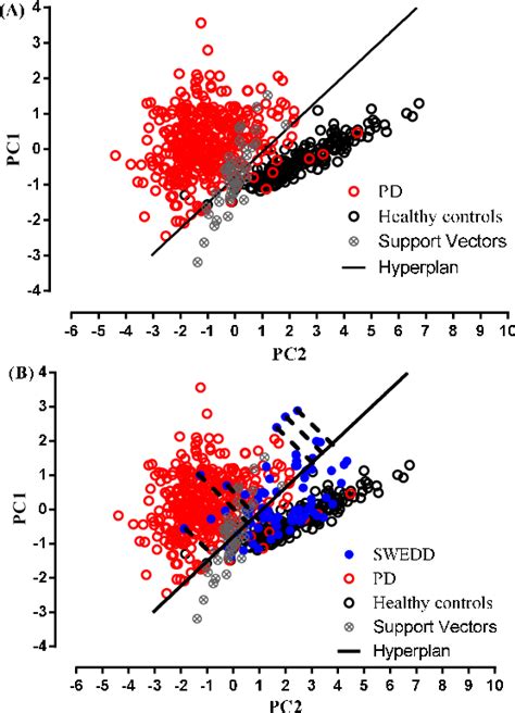Image result for DaTscan Machine