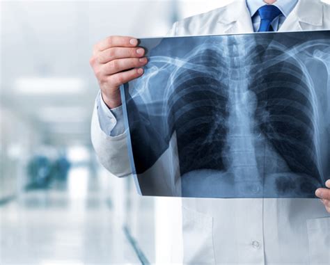 Best Radiology Services for Accurate Diagnosis | Chest Hospital