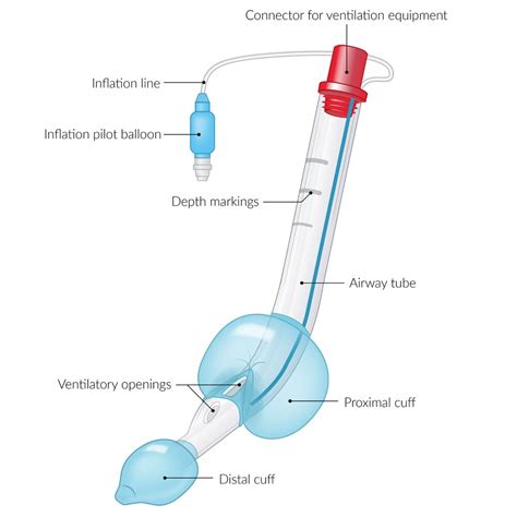 Anesthesia Airway Lavage 的图像结果
