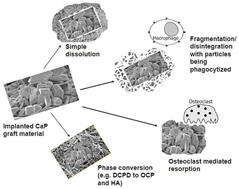 Materials | Special Issue : Regenerative Materials