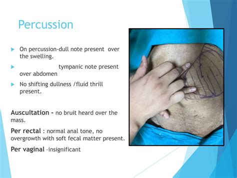 lump in abdomen (2).pptx