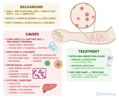 Petechiae On Knuckles at Stephanie Slayton blog