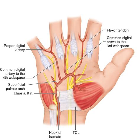 Ulnar artery to superficial arch bypass with a vein graft - Clinical Tree