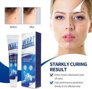 GULGLOW99 Skin Tag Remover Gel - Price in India, Buy GULGLOW99 Skin Tag ...