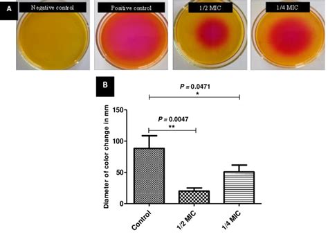 Image result for Urease