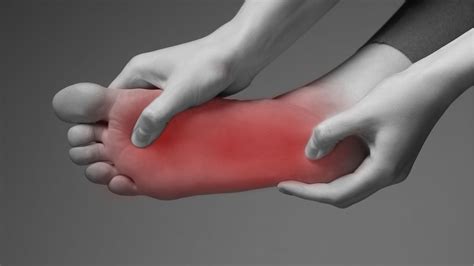 Fascite Plantar - Gustavo Nogueira - Osteopatia & Fisioterapia